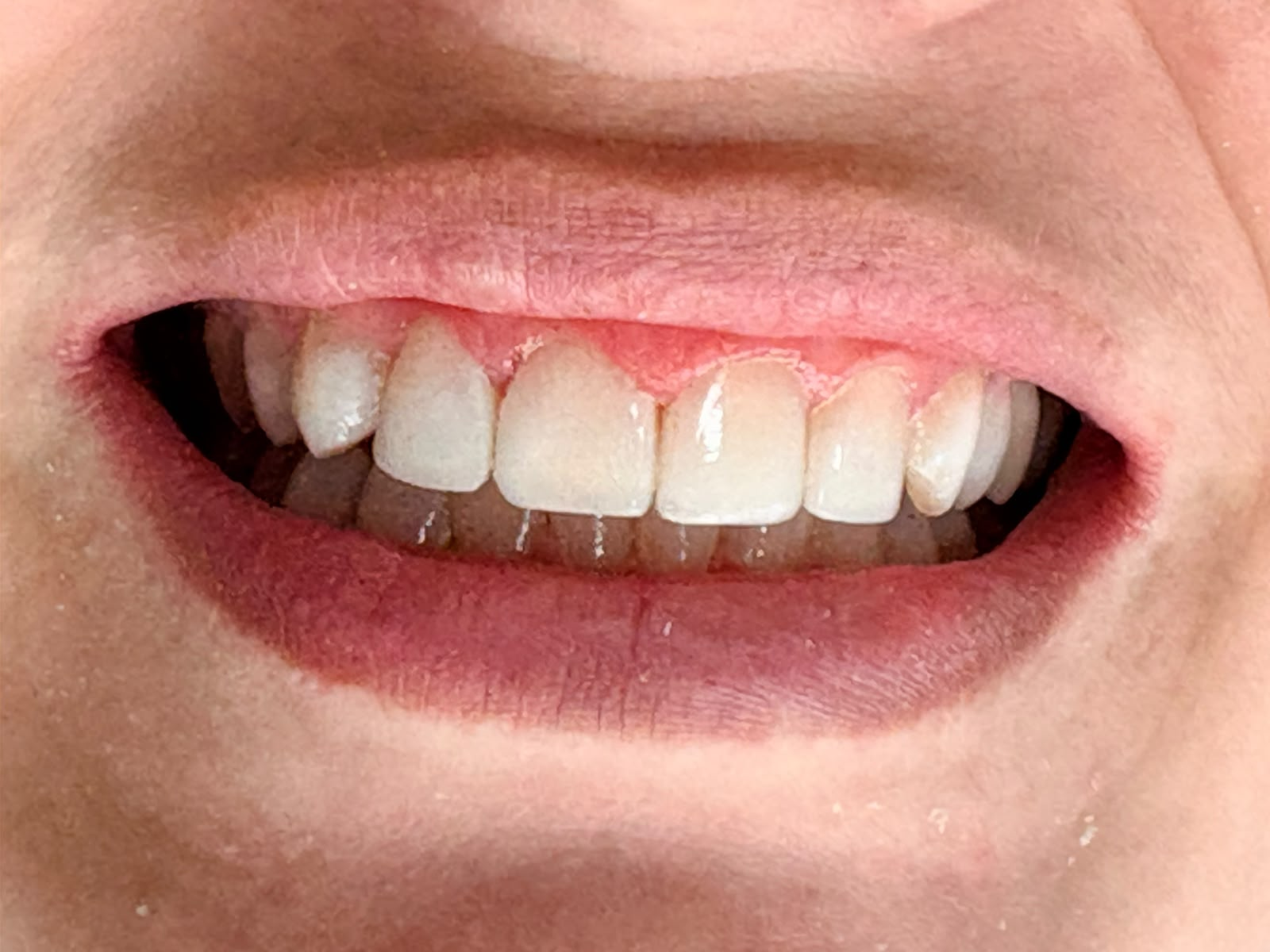 Sorriso, registro depois